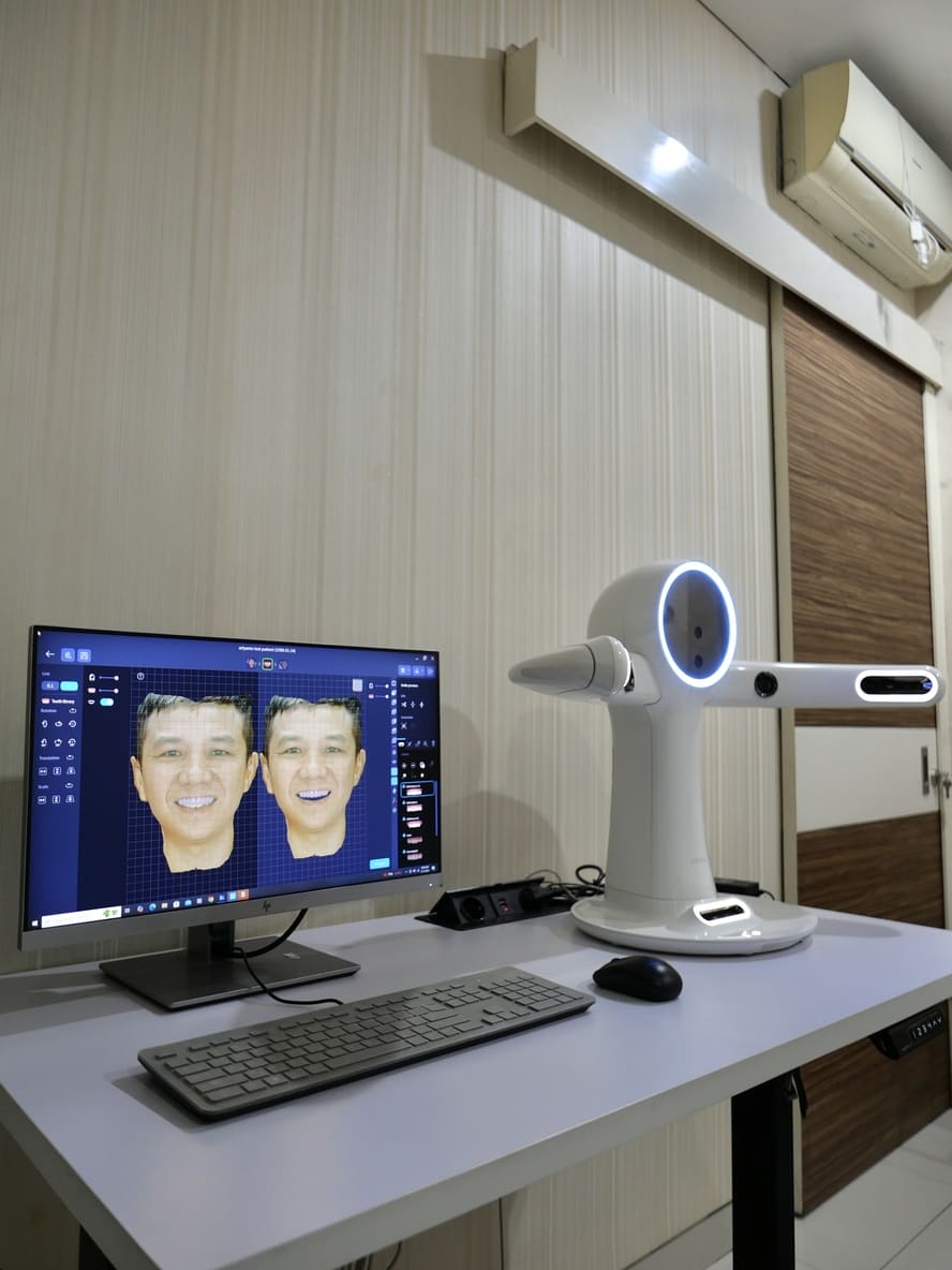 3D Digital Smile Design scanner and software at Art Denta Care